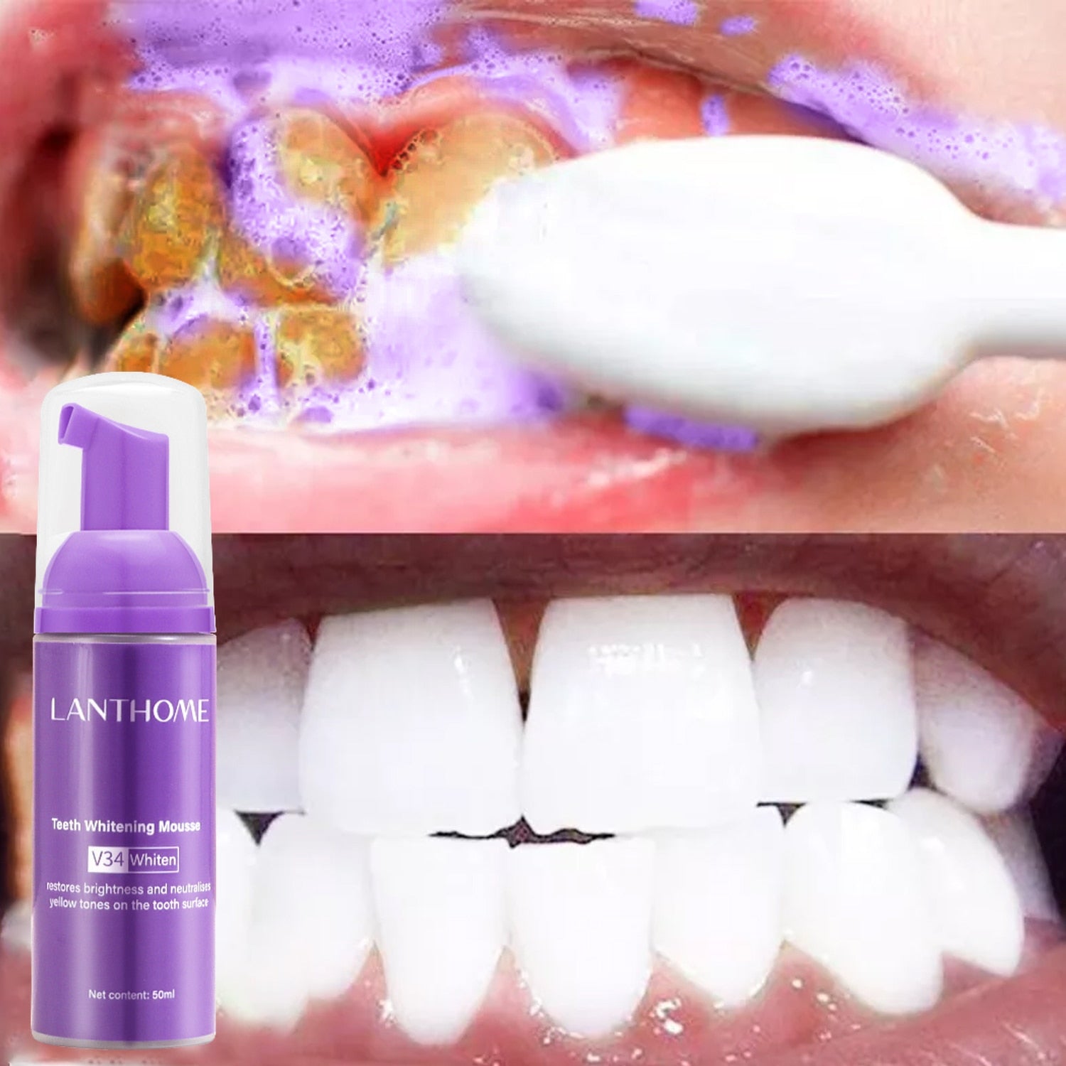 Mouth wash and teeth whitening - MarvelouStoree