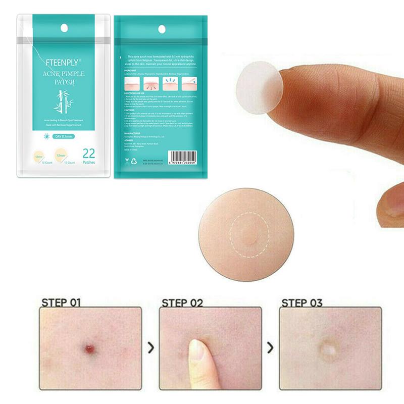 22Pcs/Sheet Acne Pimple Patch Invisible Acne Stickers Blemish Treatment Acne Master Pimple Remover Tool Skin Care