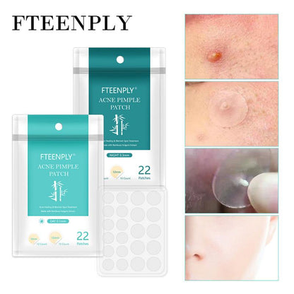 22Pcs/Sheet Acne Pimple Patch Invisible Acne Stickers Blemish Treatment Acne Master Pimple Remover Tool Skin Care