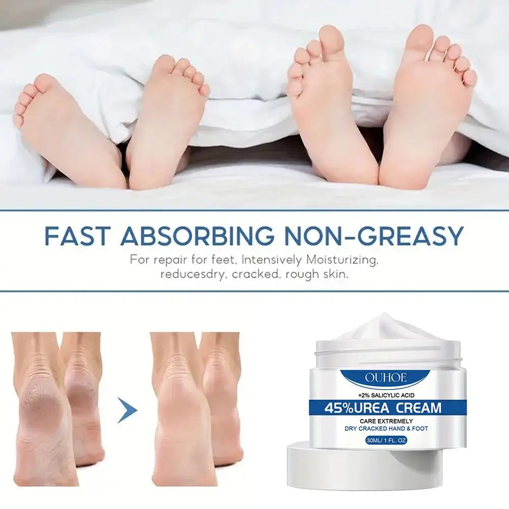 Anti Drying Foot Cream Urea Crack Heel Calluses Dead Skin Removal Soothing Chapping Repair Moisturizing Hydration Hand Feet Care