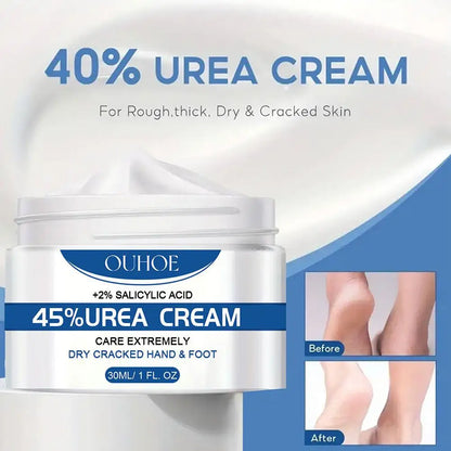 Anti Drying Foot Cream Urea Crack Heel Calluses Dead Skin Removal Soothing Chapping Repair Moisturizing Hydration Hand Feet Care