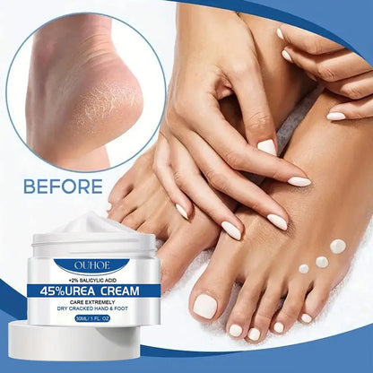 Anti Drying Foot Cream Urea Crack Heel Calluses Dead Skin Removal Soothing Chapping Repair Moisturizing Hydration Hand Feet Care