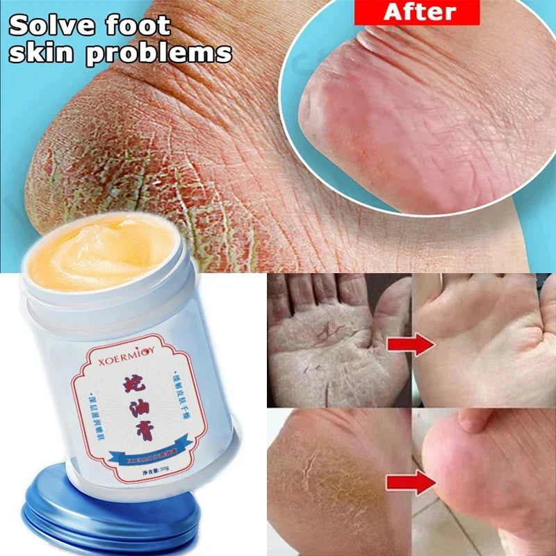 Beauty Product Herbal Anti Crack Foot Cream Heel Cracking Repair Products Exfoliation Dead Skin Removal Softening Moisturize