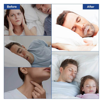 ELAIMEI Anti Snoring Sleep Strips Disposable Gentle Mouth Tape for Better Nose Breathing Reduce Mouth Dryness Sore Throat - MarvelouStoree