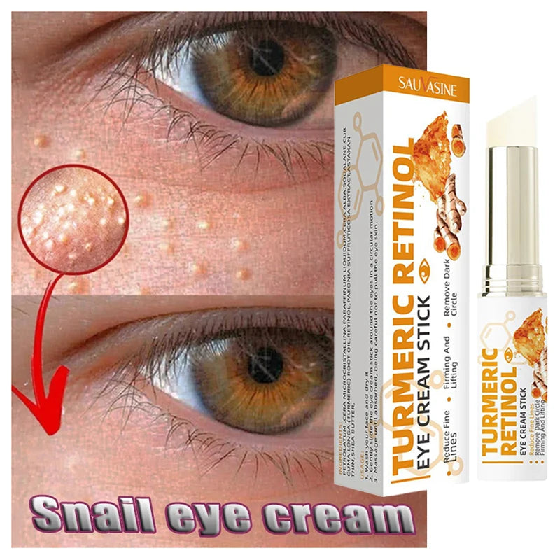 Fat Granules Removal Eye Cream Stick Anti-Puffiness Firming Anti Inflammatory Fade Fine Line Repair Skin Barrier Eye Skin Care