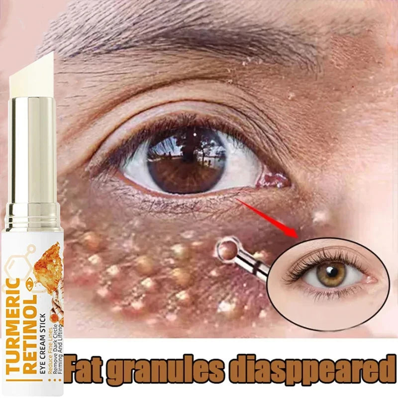 Fat Granules Removal Eye Cream Stick Anti-Puffiness Firming Anti Inflammatory Fade Fine Line Repair Skin Barrier Eye Skin Care