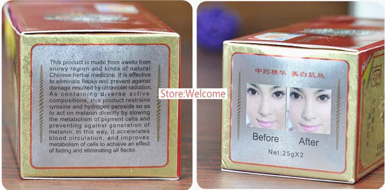 Chinese 2024 Whitening Day Night Cream Set Melasma Dark Age Dark Spots Freckle Remover Skin Lightening Skin Care