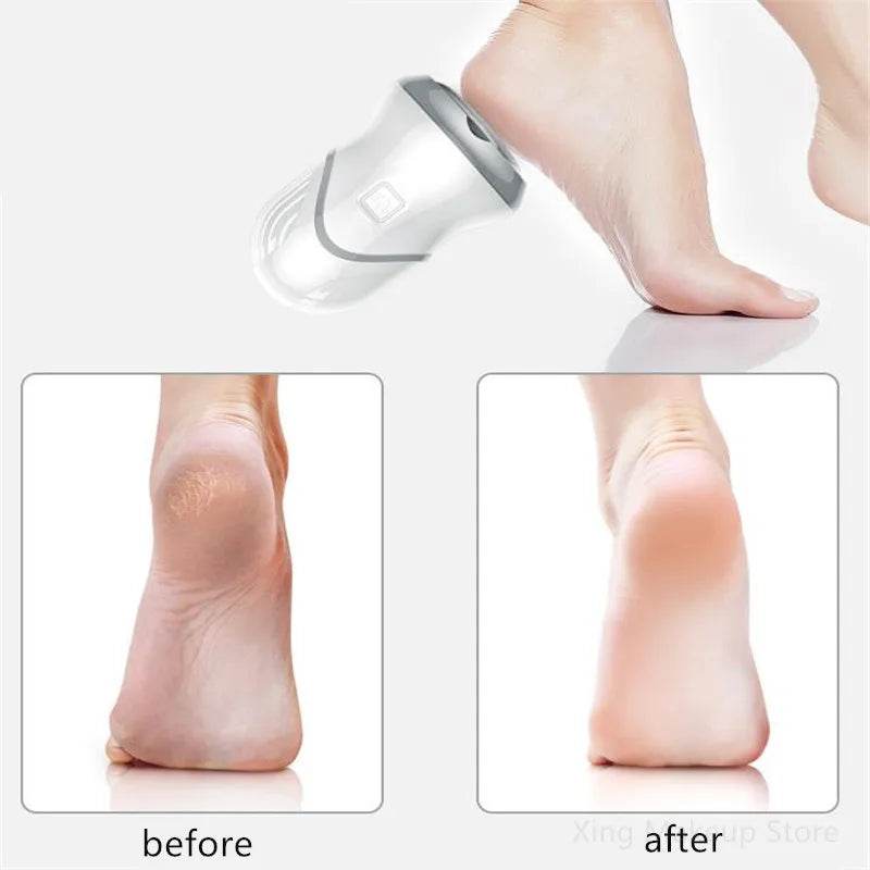 USB Charging Electric Foot Massager