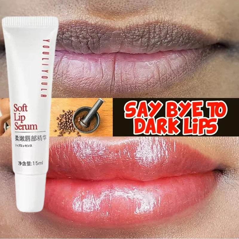 Lips Pink Fresh Lightening Bleaching Cream Treatment Remove Dark Smoke Lips Lip Balm Whitening Moisturizer Nourishing Essence - MarvelouStoree