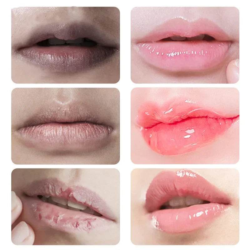 Lips Pink Fresh Lightening Bleaching Cream Treatment Remove Dark Smoke Lips Lip Balm Whitening Moisturizer Nourishing Essence - MarvelouStoree