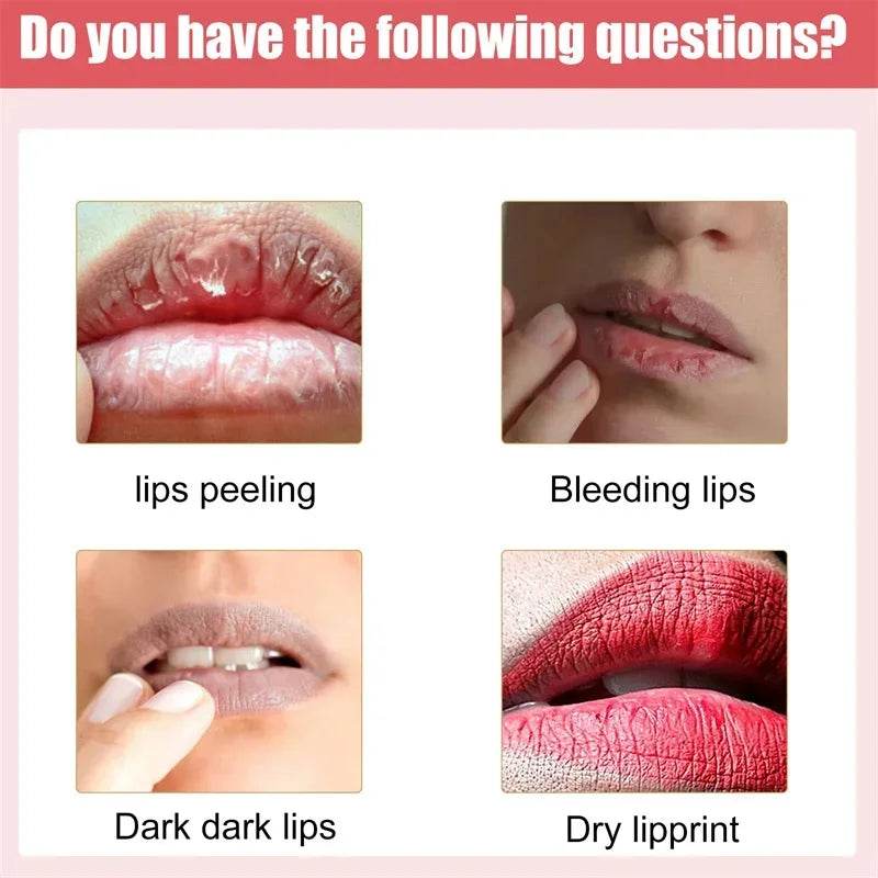 Lips Pink Fresh Lightening Bleaching Cream Treatment Remove Dark Smoke Lips Lip Balm Whitening Moisturizer Nourishing Essence - MarvelouStoree