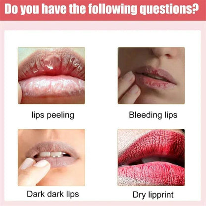 Lips Pink Fresh Lightening Bleaching Cream Treatment Remove Dark Smoke Lips Lip Balm Whitening Moisturizer Nourishing Essence - MarvelouStoree