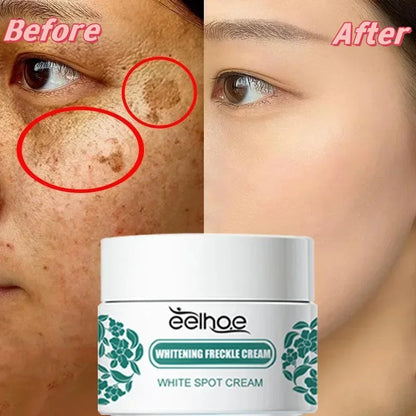 Niacinamide Melasma Brightening Cream Reduce Melanin Brighten Cream Lighten Dark Skin Chloasma Serum Fade Fine Face Lines 2024