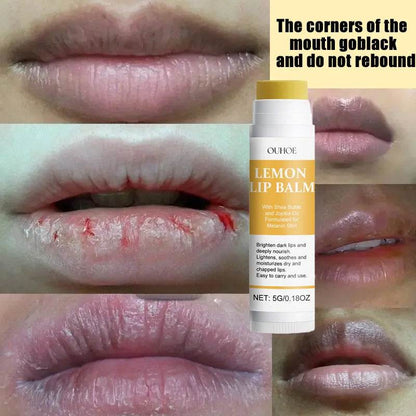 Remove Dark Lip Balm Lightening Melanin Mask Gloss Oil Exfoliating Clean Moisturizer Korean Care Products Makeup Beauty Health - MarvelouStoree