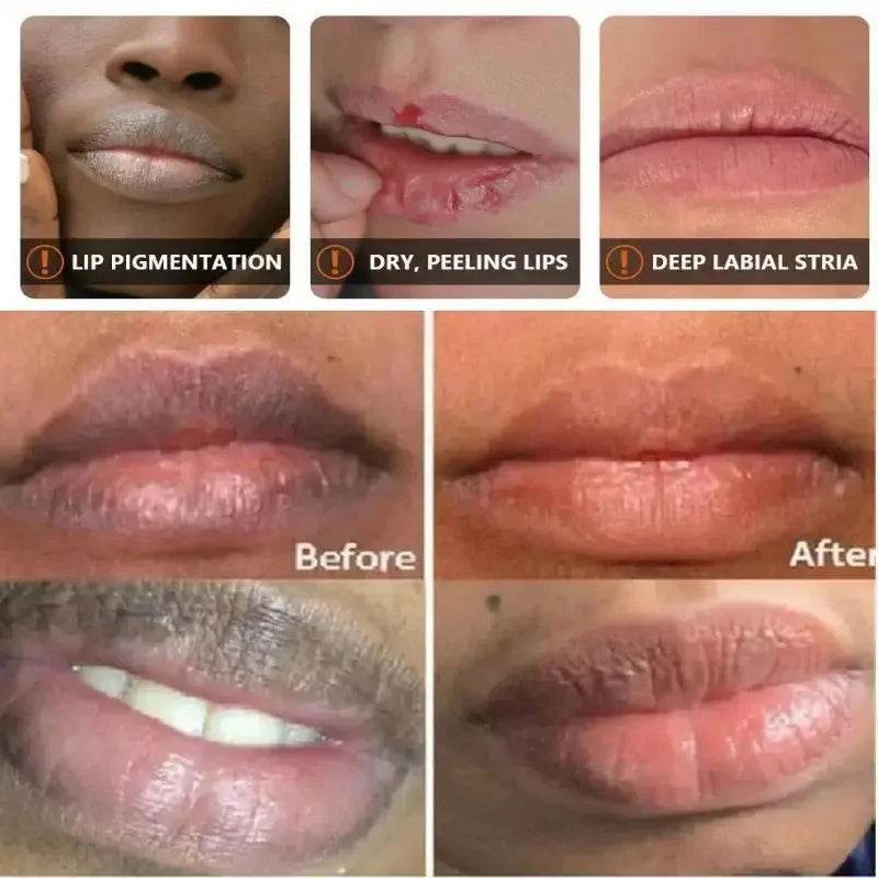 Remove Dark Lip Balm Lightening Melanin Mask Gloss Oil Exfoliating Clean Moisturizer Korean Care Products Makeup Beauty Health - MarvelouStoree