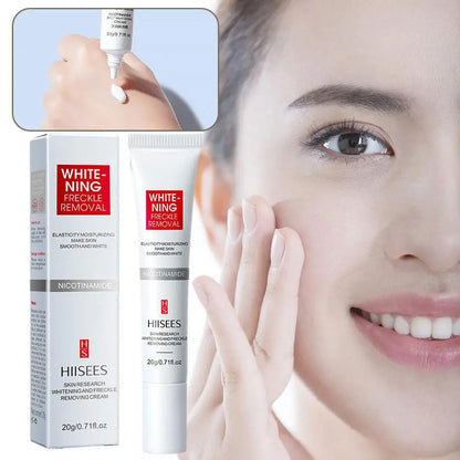 Face Freckles Cream Whitening Skin Remove Melasma Dark Spots Lighten Remover Moisturizing Brightening Cream 20g Skin Care