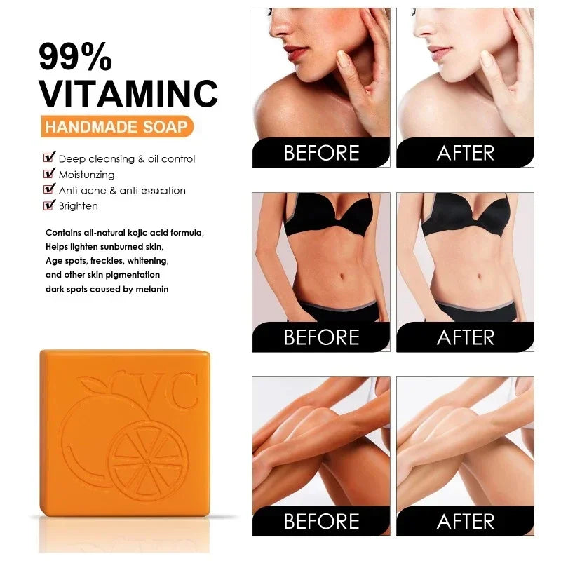 Vitamin C Orange Essence Skin Whitening Soap100g Skin Brightening Gentle Knee Knuckle Elbow Face Body Dark Spot Remover Soap Bar