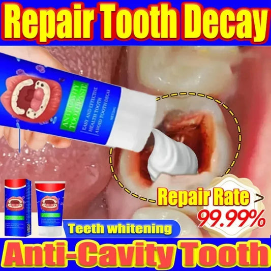 Teeth Whitening Toothpaste Removing Dental Calculus Protect Teeth Freshens Breath Anti-cavity Tooth Relieve Periodontitis New