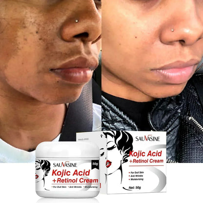 Remove Pigment Melanin Whitening Face Cream Remove Dark Spots Cream Nourishing & Resurfacing Fade Skin Care Kojic Acid Cream