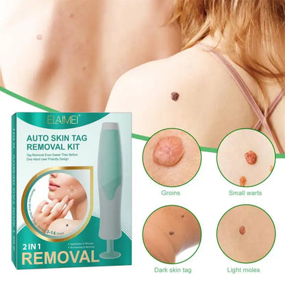 Skin Tag Removal Kit Easy And Painless Includes Cleansing Swabs Dermatologist Recommended Safe And Effective Safe Affordable