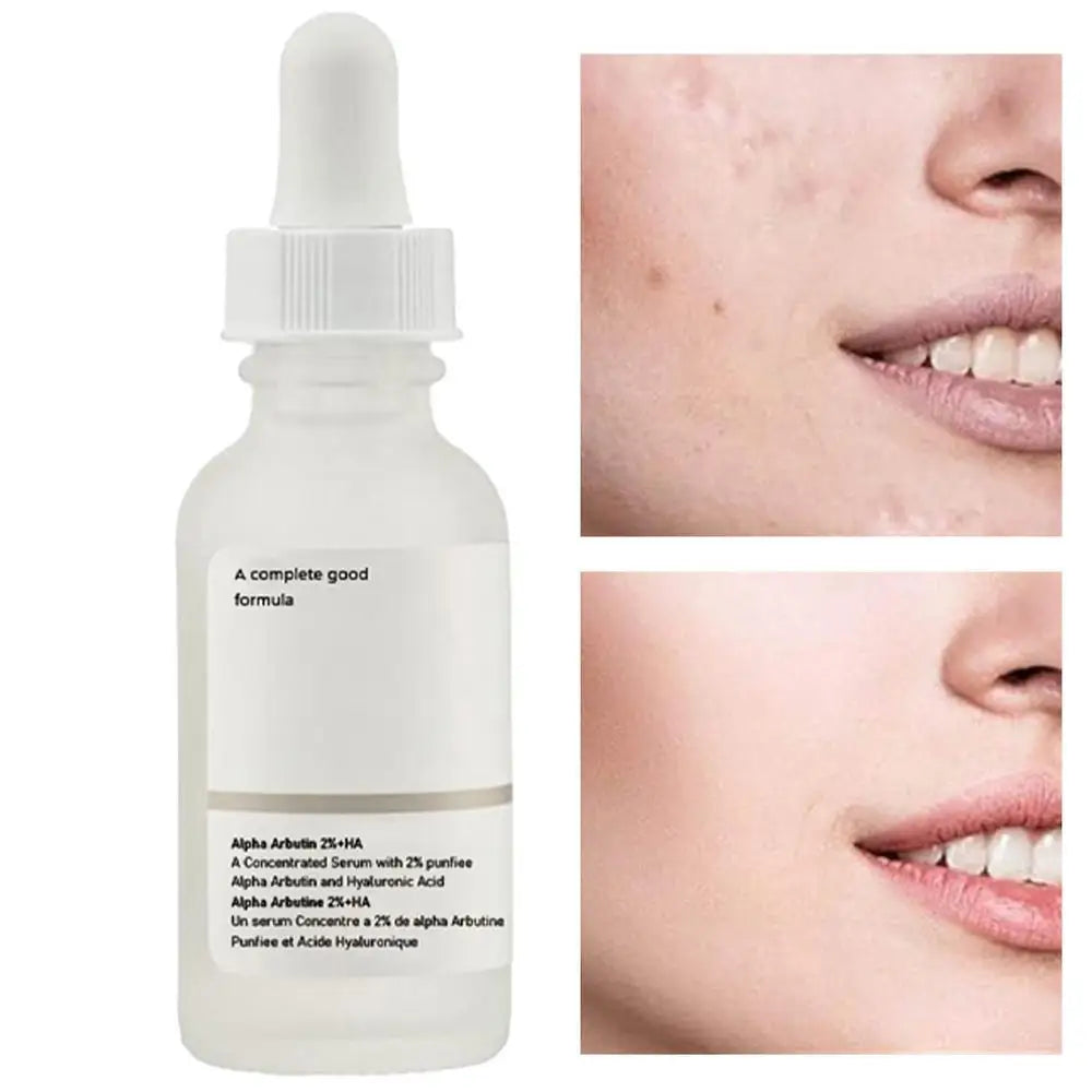 30ml Arbutin Stock Solution Rejuvenating Essence Brightens Skin Decomposes Pigments Whiten Improves Bleaching Dark Spot Serum