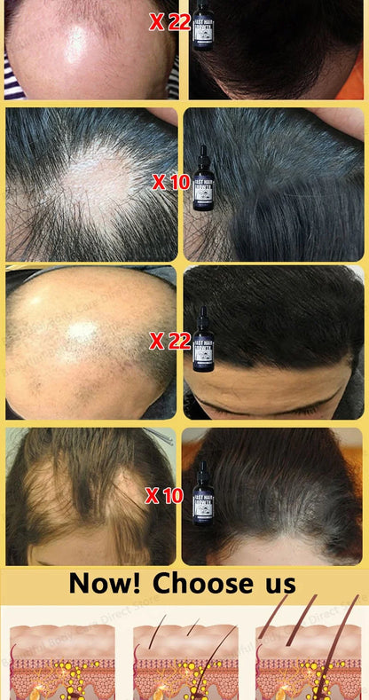 【Hot Selling】Miracle Hair Growth Essence, Awakening Hair Follicle Vitality