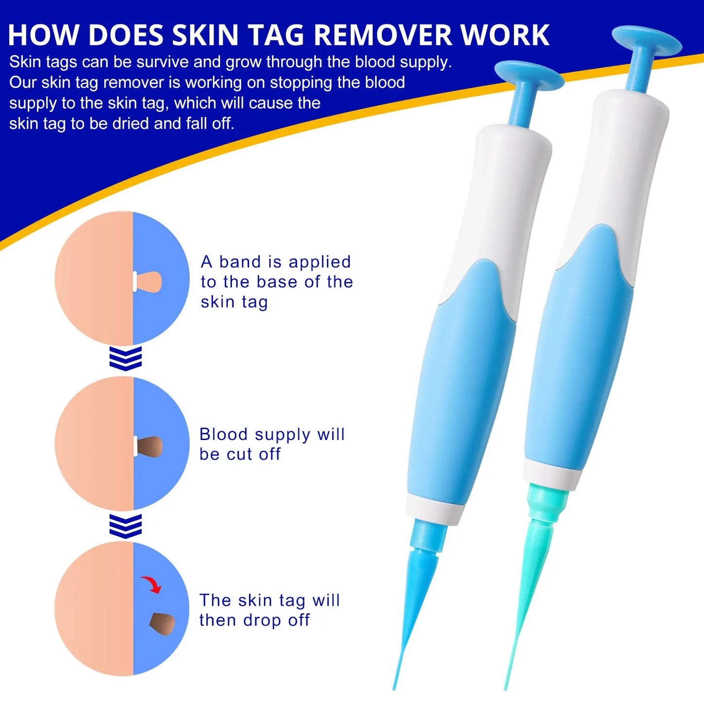 Skin Tag Remover Kit Mole Wart Remover Equipment Skin Tag Treatment Tool Facial Beauty Tool Home Use Easy To Clean