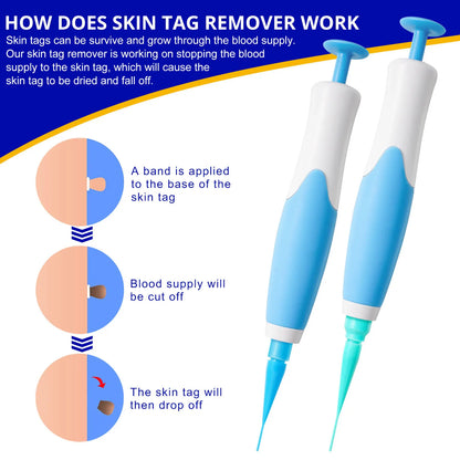 Skin Tag Remover Kit Mole Wart Remover Equipment Skin Tag Treatment Tool Facial Beauty Tool Home Use Easy To Clean