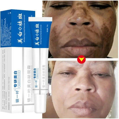 Whitening Freckle Cream Melasma Dark Spots Pigmentation Removal Products Fade Stain Melanin Repair Brighten Korean Skin Care