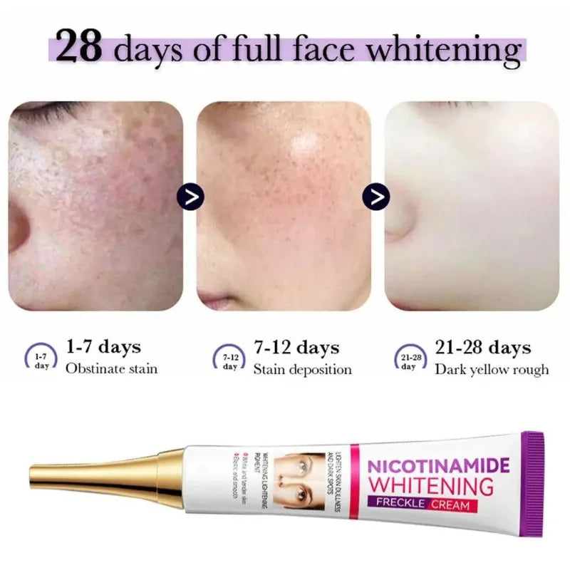 Face Melasma Remover Cream Whitening Removal Freckles Cream Nicotinamide Moisturizing Brightening Emulsion Fade Dark Spots Cream