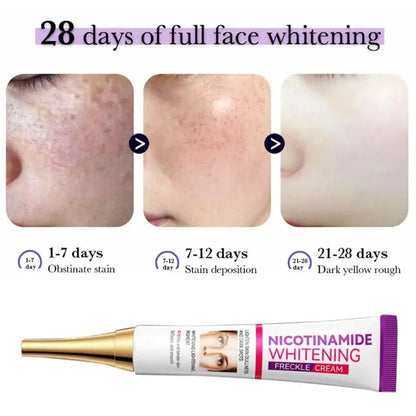 Mild Niacinamide Lightening Melasma Cream Effectively Fade Melanin Bleaching Cream Remove Dark Pigment Moisturizing Skin Care