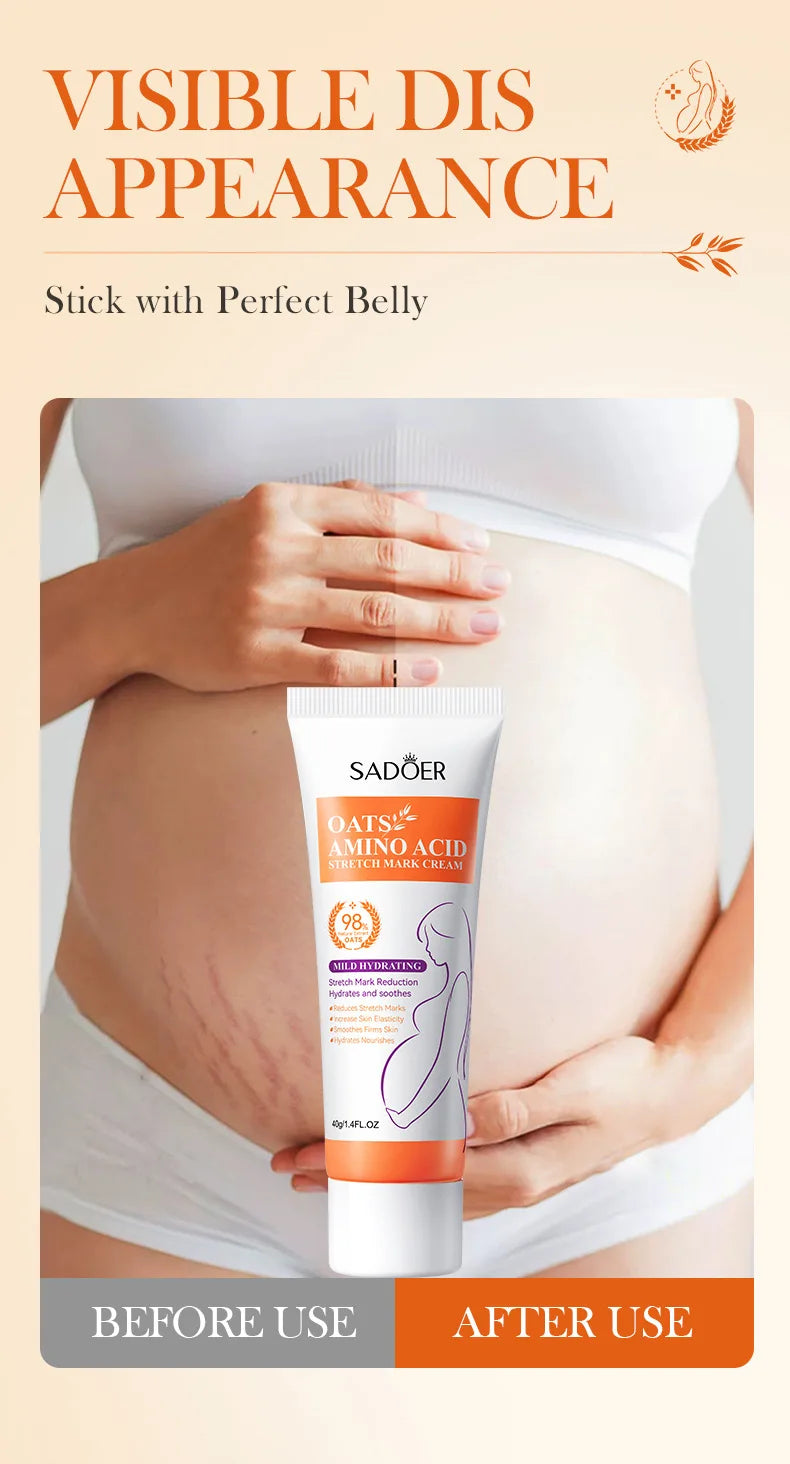 Stretch Marks Permanent Removal Cream Eliminate Body Belly Stretch Marks Swelling Marks Remove Skin Cracks Repair Firming Care