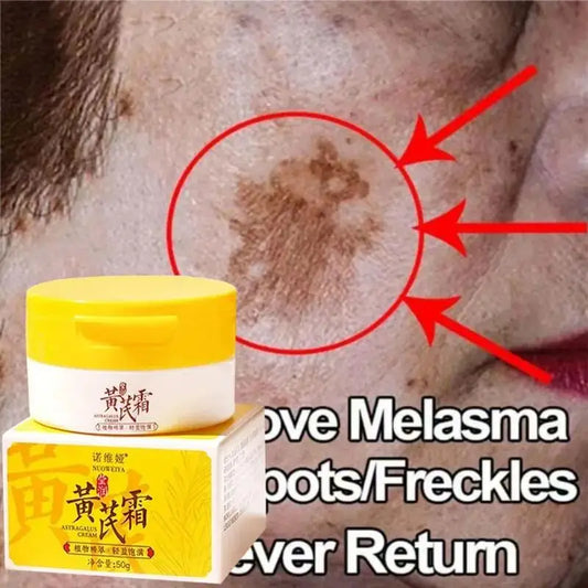 Astragalus Whitening Freckles Face Cream Remove Dark Spots Melasma Lighten Melanin Acne Scars Anti-aging Brighten Skin Care 50g