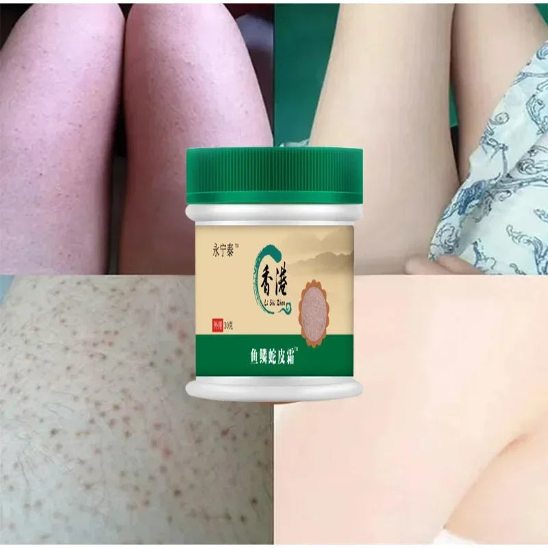 Chicken Skin Removal Treatment Body Scrub Cream Remove Dead Skin Cell Pore Spot Dull Whitening Moisturizing Body Care Cream