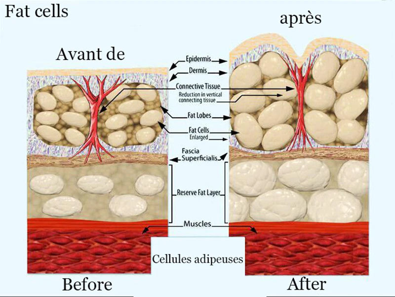 West Africa Buttock Exercise Butt Enlargement Oil Breast Enhancement Hips Enlarge Hip Fat Cells Get Bigger butt By Walking 30 ml