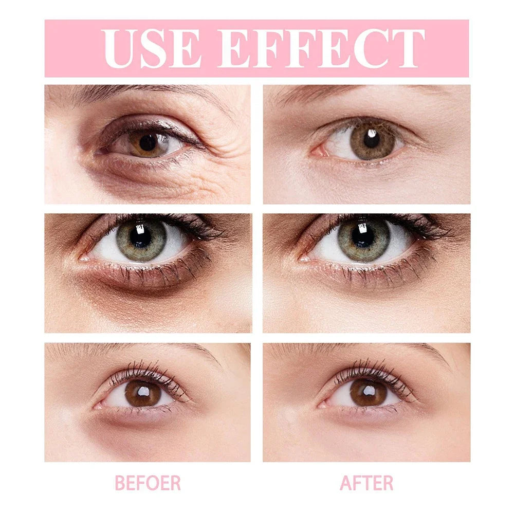 Retinol Eye Cream Instant Remove Eye Wrinkles Eye Dark Circles Bags Remover Moisturising Stick Beauty Health Korean Cosmetics