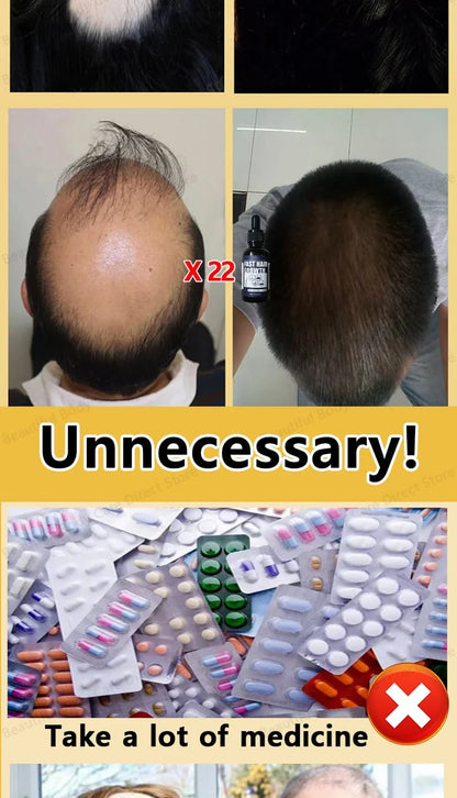 【Hot Selling】Miracle Hair Growth Essence, Awakening Hair Follicle Vitality