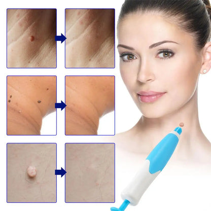 2 In1 Painless Auto Skin Tag Mole Removal Kit Cleaning Tools Face Skin Care Body Dot Treatments Remover Beauty Health