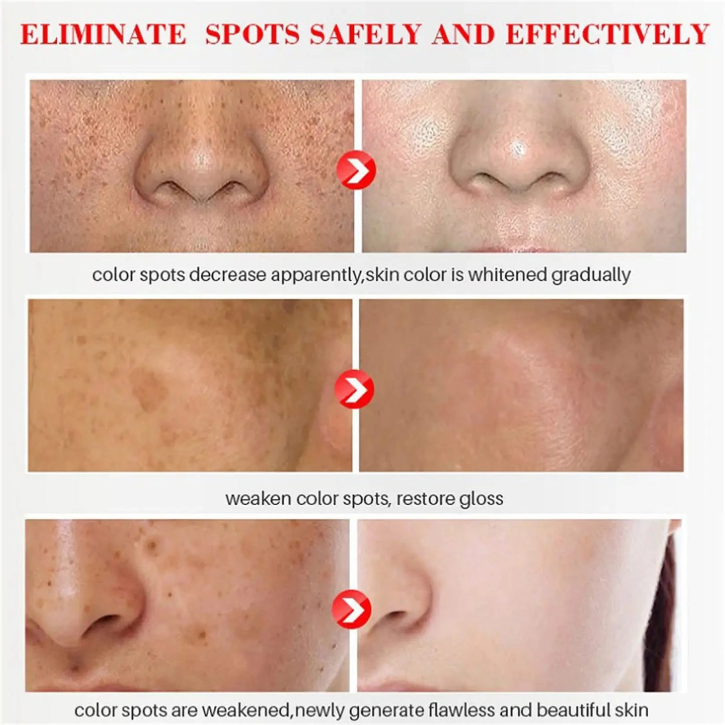 Niacinamide Dark Spot Remove Serum Anti-aging Bright Freckle Whiten Skin Cream Fade Pigmentation Melasma Moisture Face Skin Care