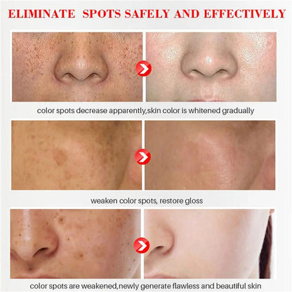 Niacinamide Dark Spot Remove Serum Anti-aging Bright Freckle Whiten Skin Cream Fade Pigmentation Melasma Moisture Face Skin Care