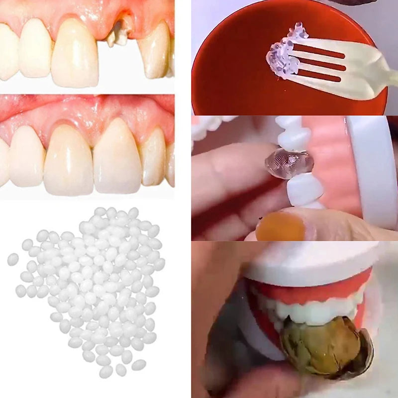 10g-30g Temporary Tooth Repair Kit Teeth And Gaps FalseTeeth Solid Glue Denture Adhesive Teeth Whitening Tooth Beauty Tool