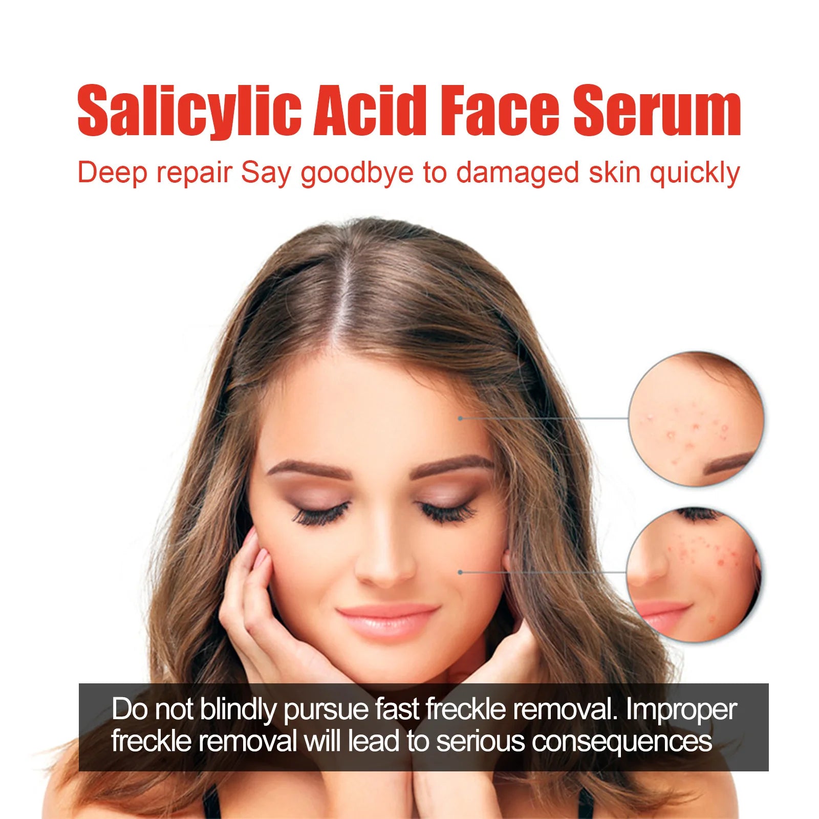 30ml Salicylic Acid Facial Serum Effectively Remove Melasma Lighten Dark Spots Acne Marks And Brighten Skin Tone