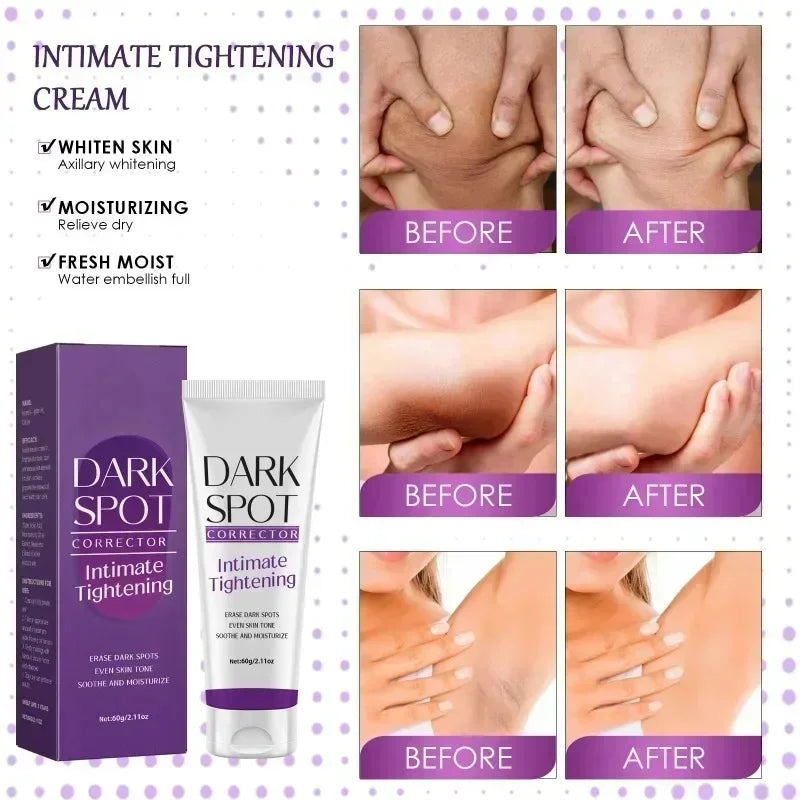 Nicotinamide Brightening Cream For Dark Skin Effective Lighten Thigh Inner Bleach Remove Melanin Private Parts Brighten CreamNEW