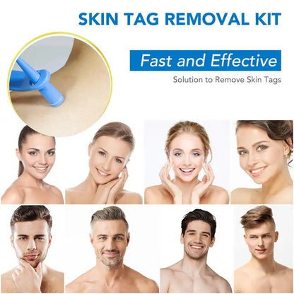 Tags Skin Remover Kit Dual-head Skin Tags Bands Remover Kit Safe Skin Tags Repair Tool With 40 Rubber Bands To Remove 2-7mm