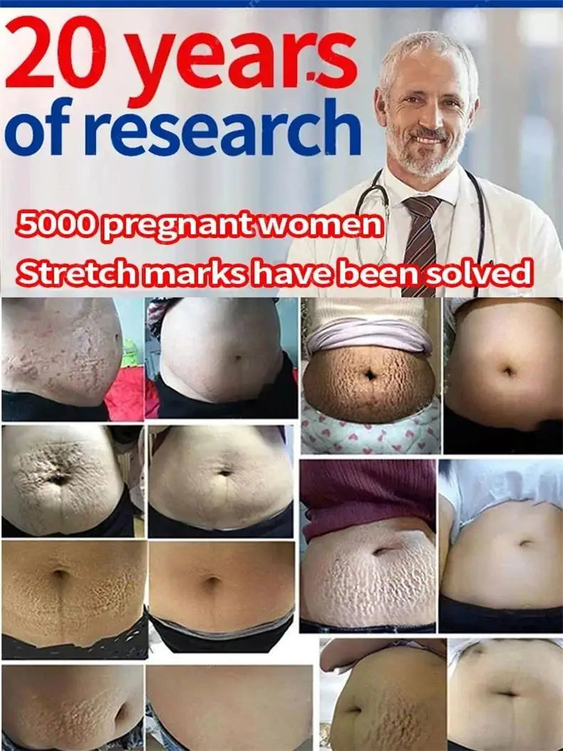 Stretch Marks Permanent Removal Cream Eliminate Body Belly Stretch Marks Swelling Marks Remove Skin Cracks Repair Firming Care