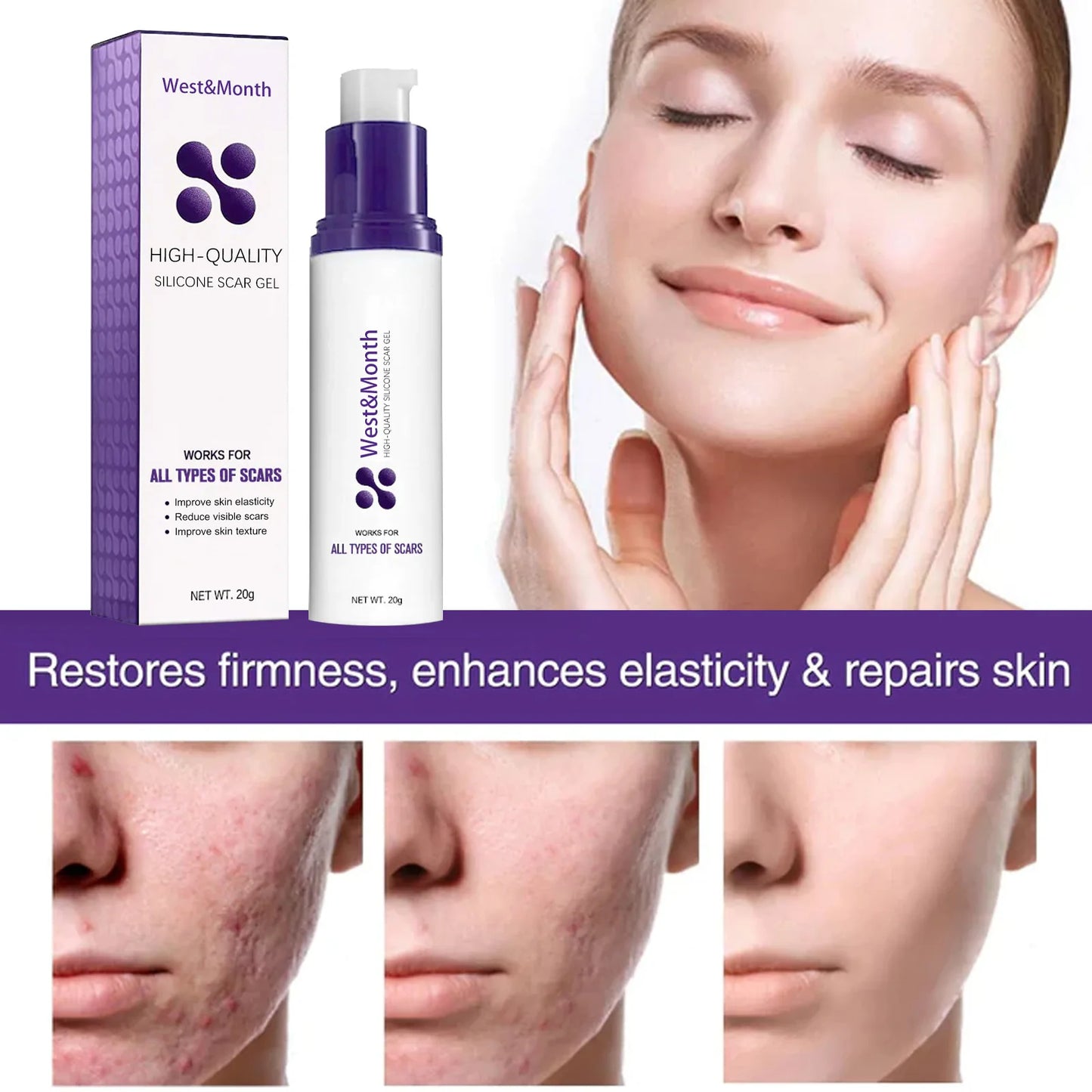 Recovery Scar Cream Fast Remove Deep Skin Scar Acne Stretch Marks Burn Keloid Spot Treat Gel Herbal Smooth Whiten Face Skin Care