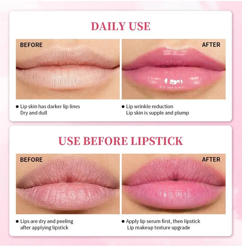 2023 New Lips Bleach Moisturizing Fresh Serum Effective Reduce Pigmentation Pink Whiten Plumper Sexy Lip Balms Korean Cosmetics