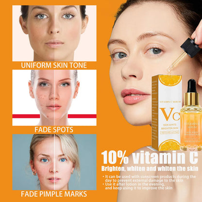 Vitamin C Remove Dark Spots face Serum Whiten Fade Freckles Anti-wrinkle Brighten Moisturize Collagen Korean Face Care Makeup