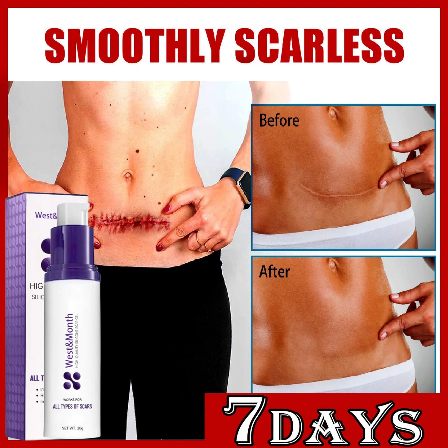 Recovery Scar Cream Fast Remove Deep Skin Scar Acne Stretch Marks Burn Keloid Spot Treat Gel Herbal Smooth Whiten Face Skin Care