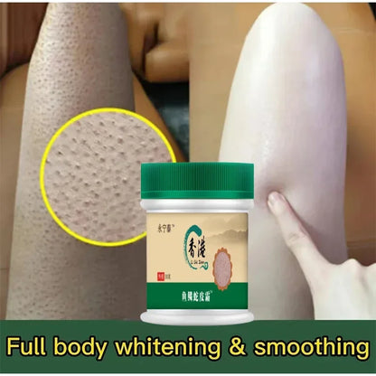 Chicken Skin Removal Treatment Body Scrub Cream Remove Dead Skin Cell Pore Spot Dull Whitening Moisturizing Body Care Cream